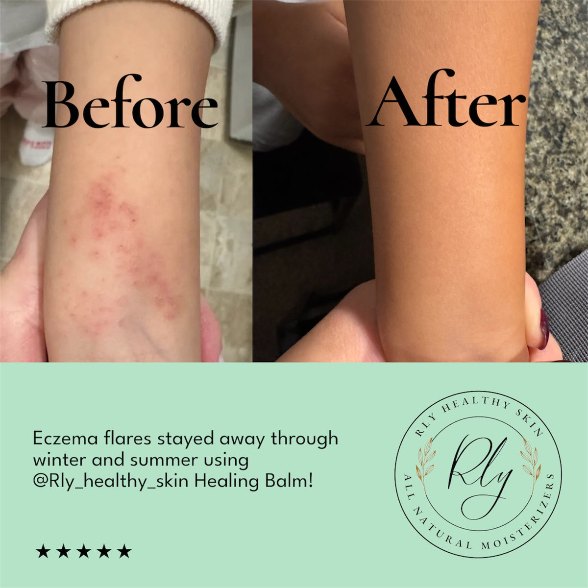Healing & Restoring Balm