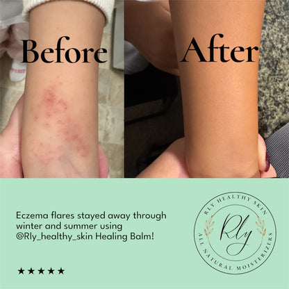 Healing & Restoring Balm